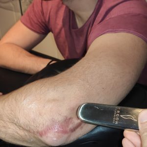 Χειροπρακτική