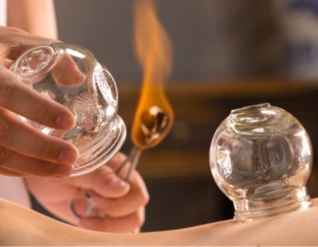 body-therapy-and-massage-ventouzotherapeia-kallithea-sportshunter-6