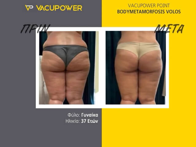 before_after_vacupower_01 Medium