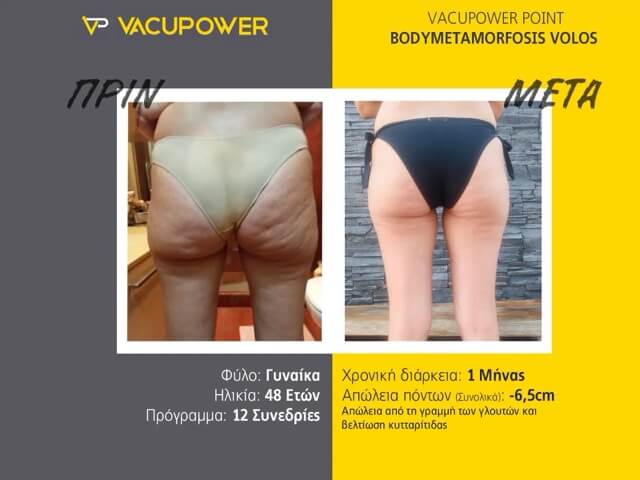 before_after_vacupower_02 Medium