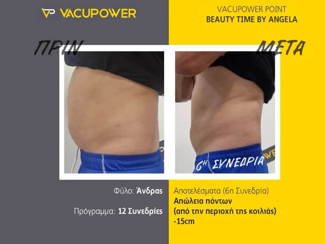 before_after_vacupower_04 Medium