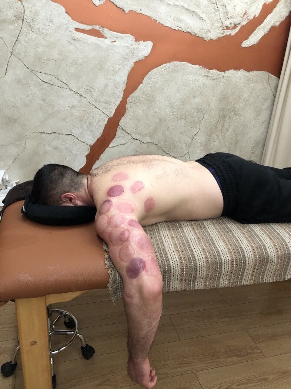 the-healing-touch-ventouzotherapeia-acharnes-sportshunter-15