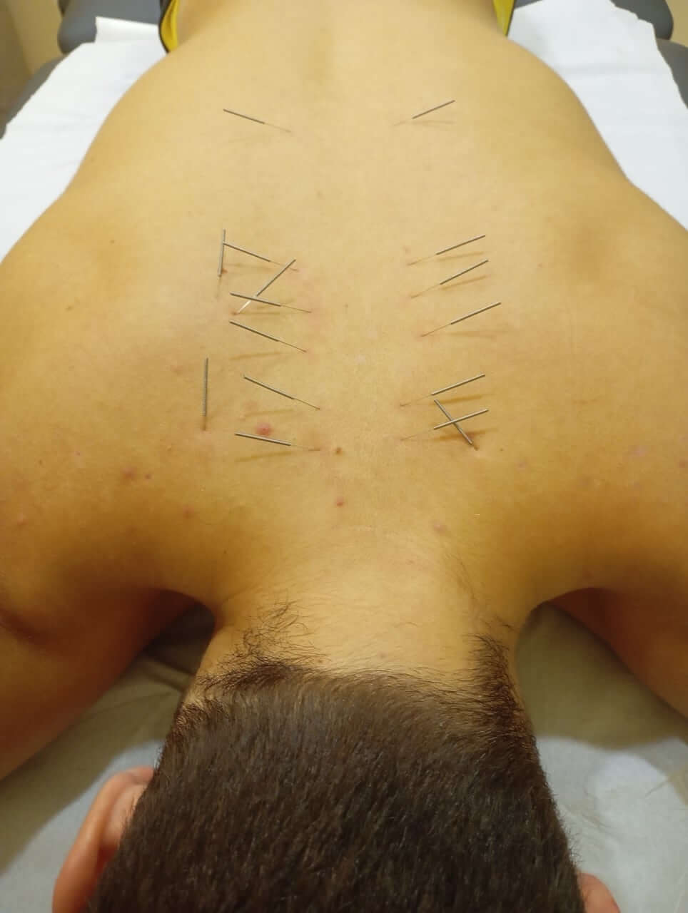 physio-mastic-velonismos-chios-sportshunter-2