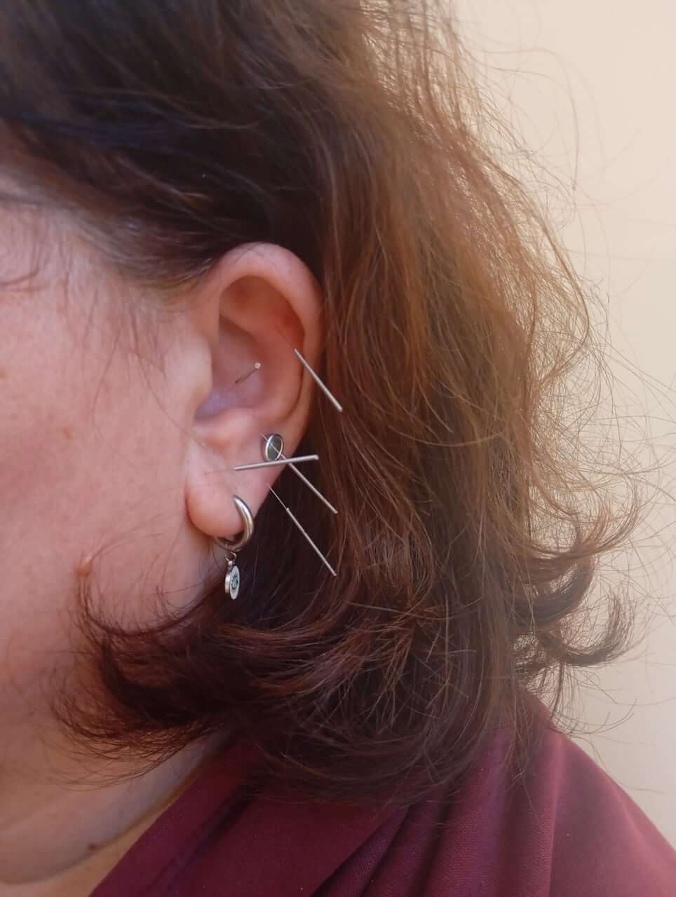 physio-mastic-velonismos-chios-sportshunter-3