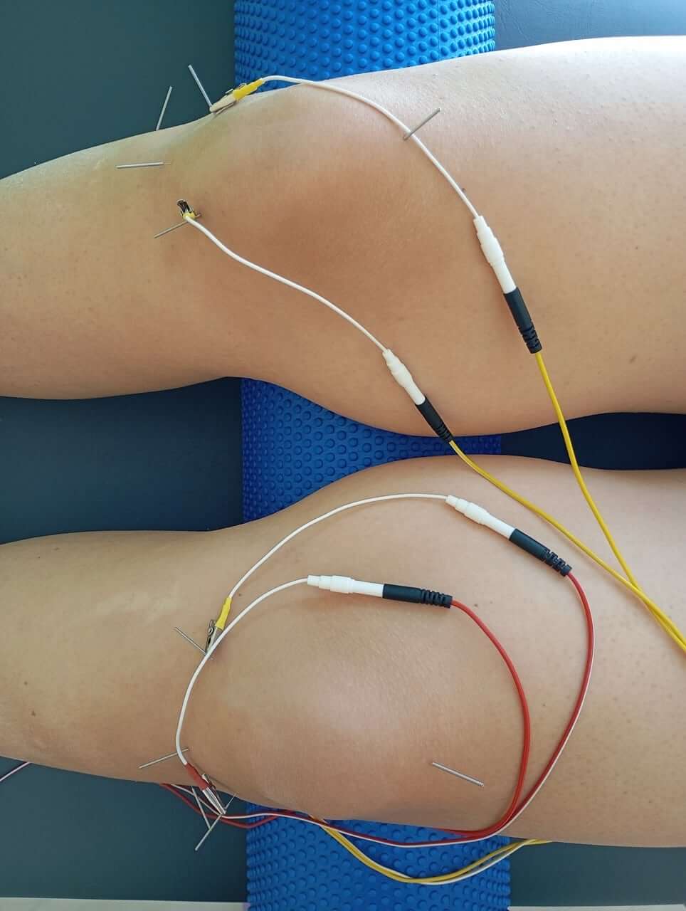 physio-mastic-velonismos-chios-sportshunter-5